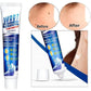 Wart Remover Gel Buy Get 199
